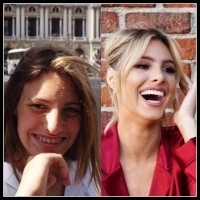 Jak chirurgia plastyczna może zmienić życie...